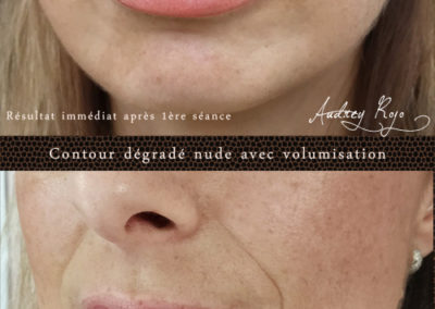 Dermopigmentation des lèvres