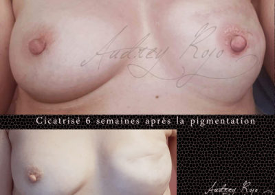 Aréole mammaire tatouée