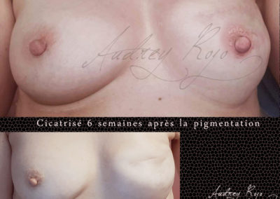 Aréole mammaire tatouée
