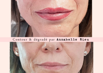 Dermopigmentation des lèvres