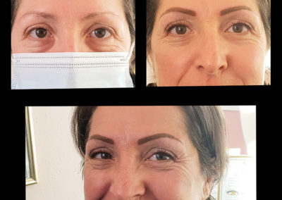 Tatouage des sourcils aux encres