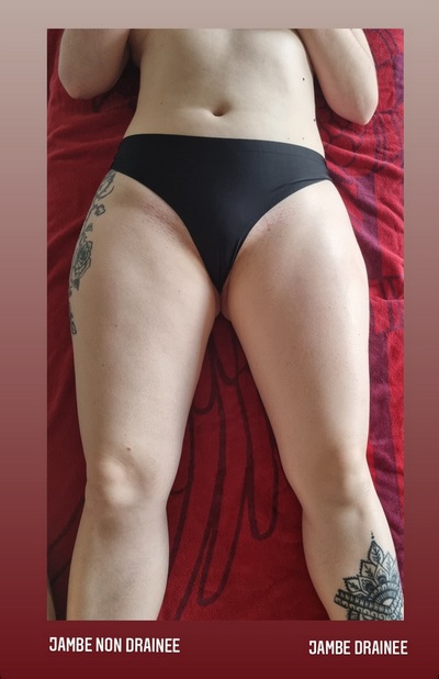 drainage Renata, jambes