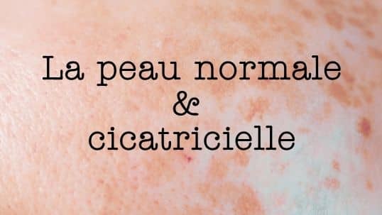 Programme de formation sur La peau cicatricielle Programme de formation sur La peau cicatricielle