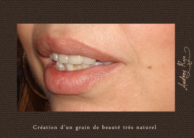 Grain de beauté tatoué