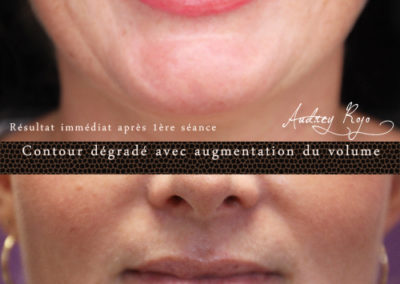 maquillage permanent des lèvres