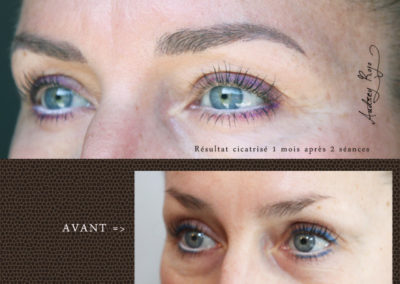 Sourcils en maquillage permanent