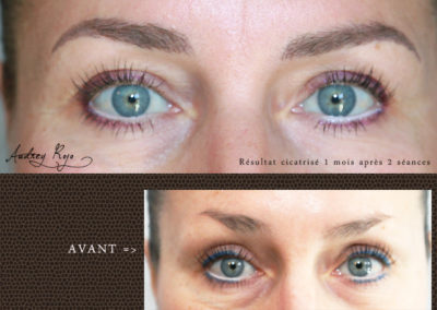 Sourcils en maquillage permanent