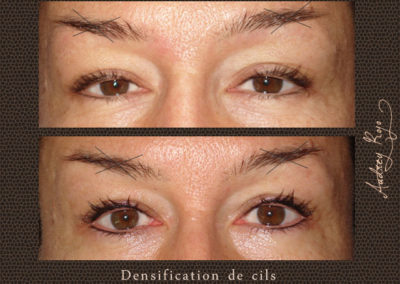 Densification de cils